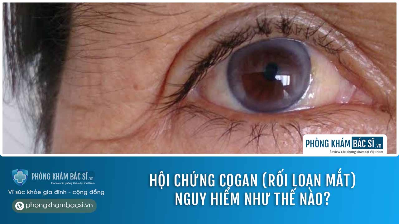 Hội chứng Cogan (Rối loạn mắt): Nguyên nhân, triệu chứng & Cách điều trị