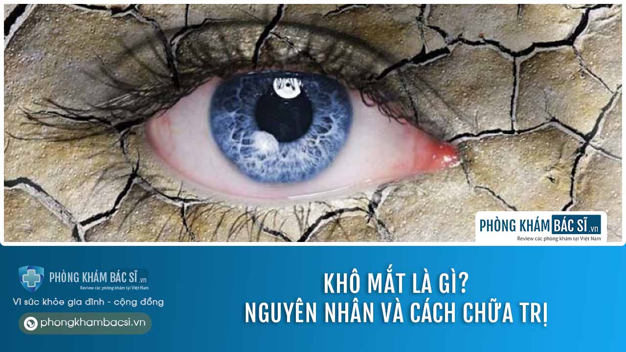 Khô mắt là gì? Nguyên nhân và cách chữa trị