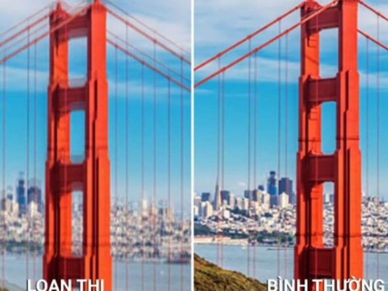 Mắt bị nhòe hoặc chói khi nhìn vật