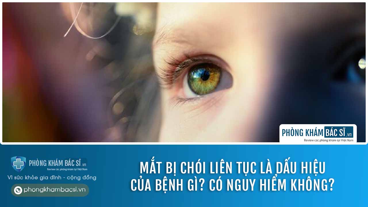 Mắt bị chói liên tục là dấu hiệu của bệnh gì? Có nguy hiểm không?