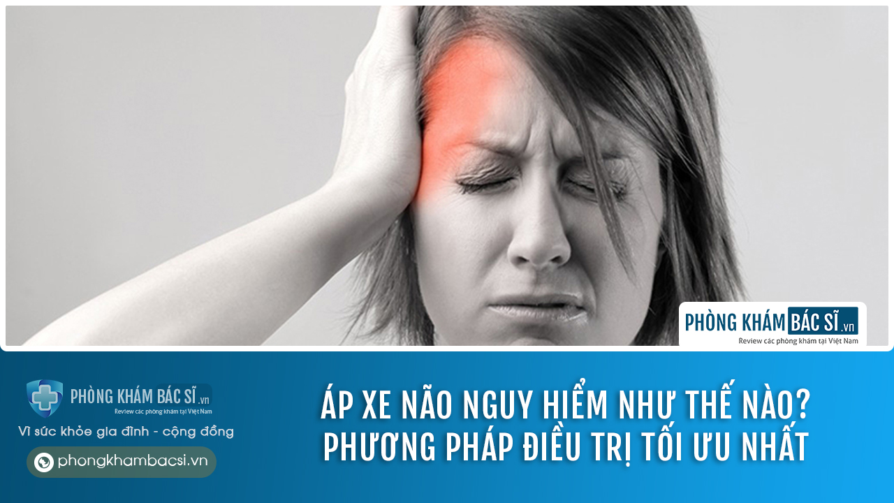 Áp xe não là gì? Nguyên nhân, Dấu hiệu và Cách chữa trị