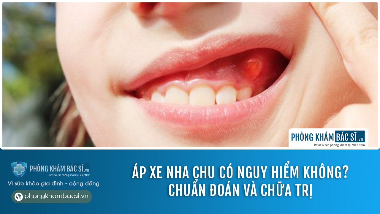 Áp xe nha chu có nguy hiểm không? Chuẩn đoán và chữa trị