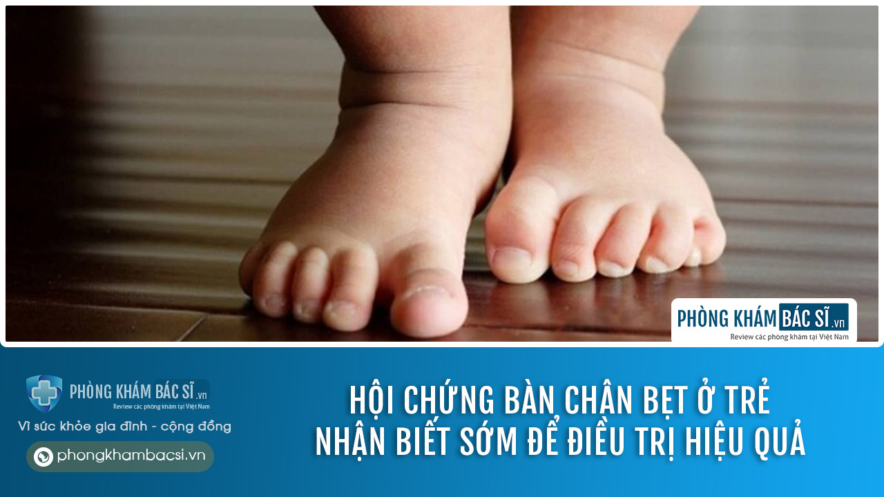 Hội chứng bàn chân bẹt là gì? Nhận biết sớm để chữa trị hiệu quả