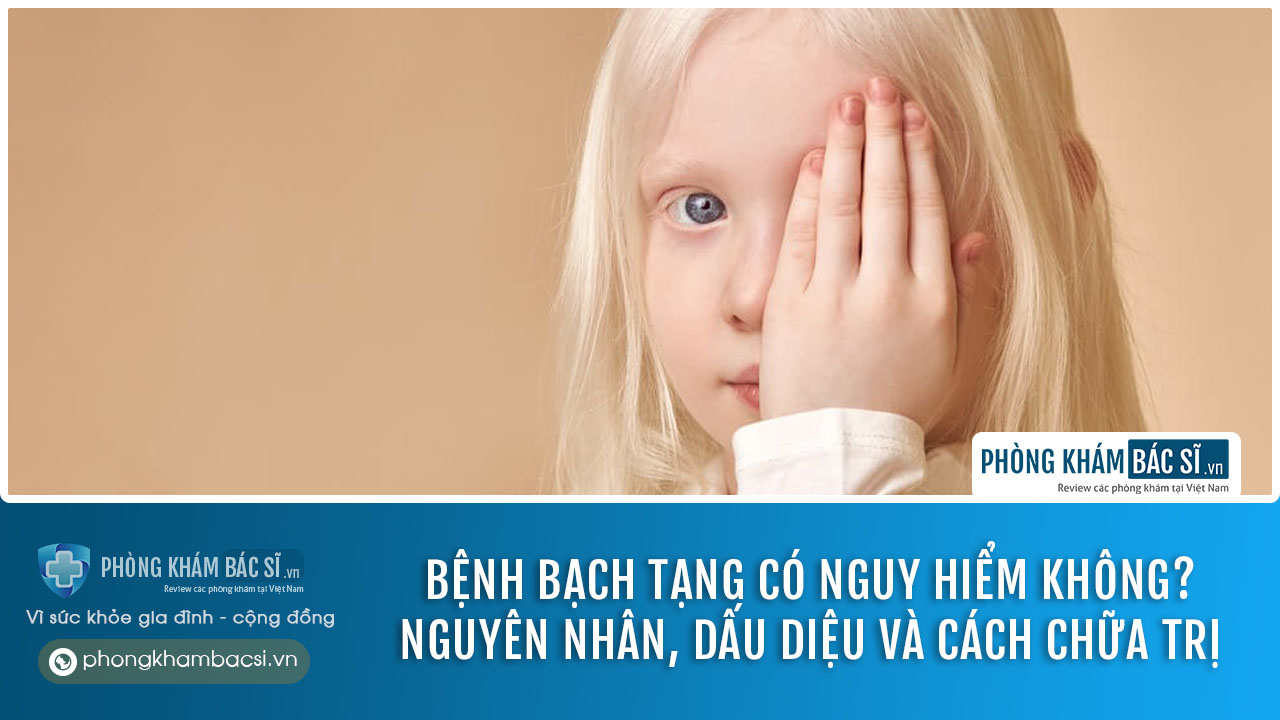 Bệnh bạch tạng ở người: Nguyên nhân, dấu diệu và cách chữa trị