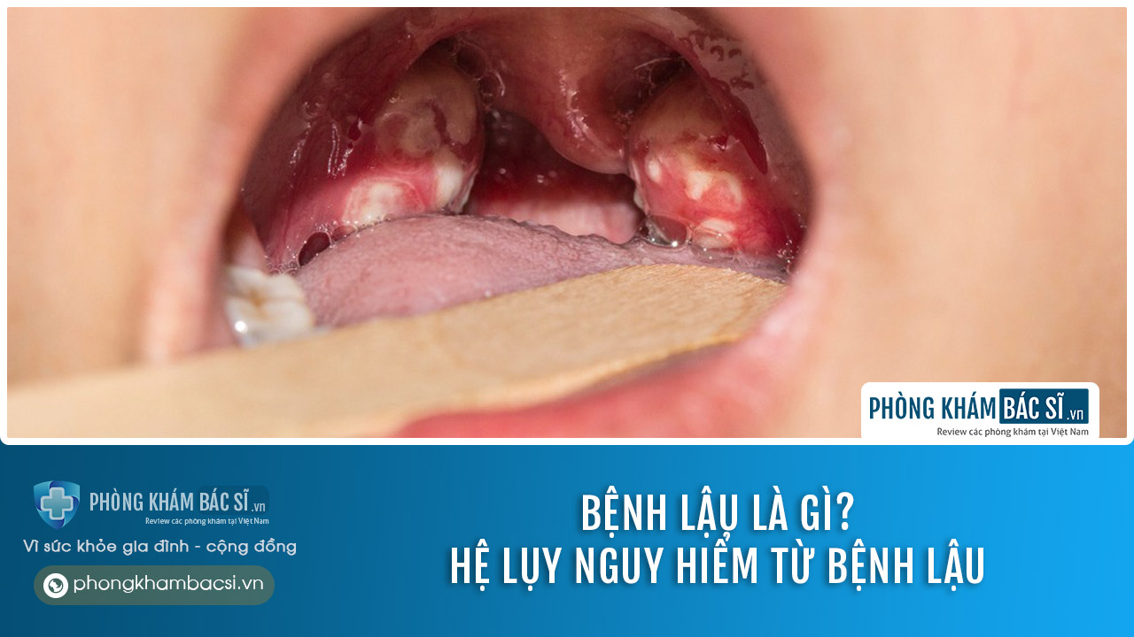 Bệnh lậu là gì? Nguyên nhân, triệu chứng và chữa trị