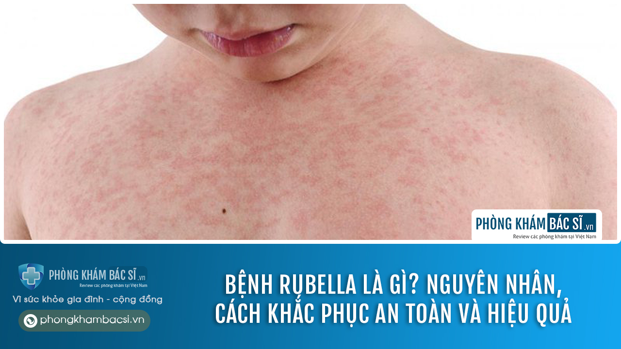 chữa trị bệnh rubella