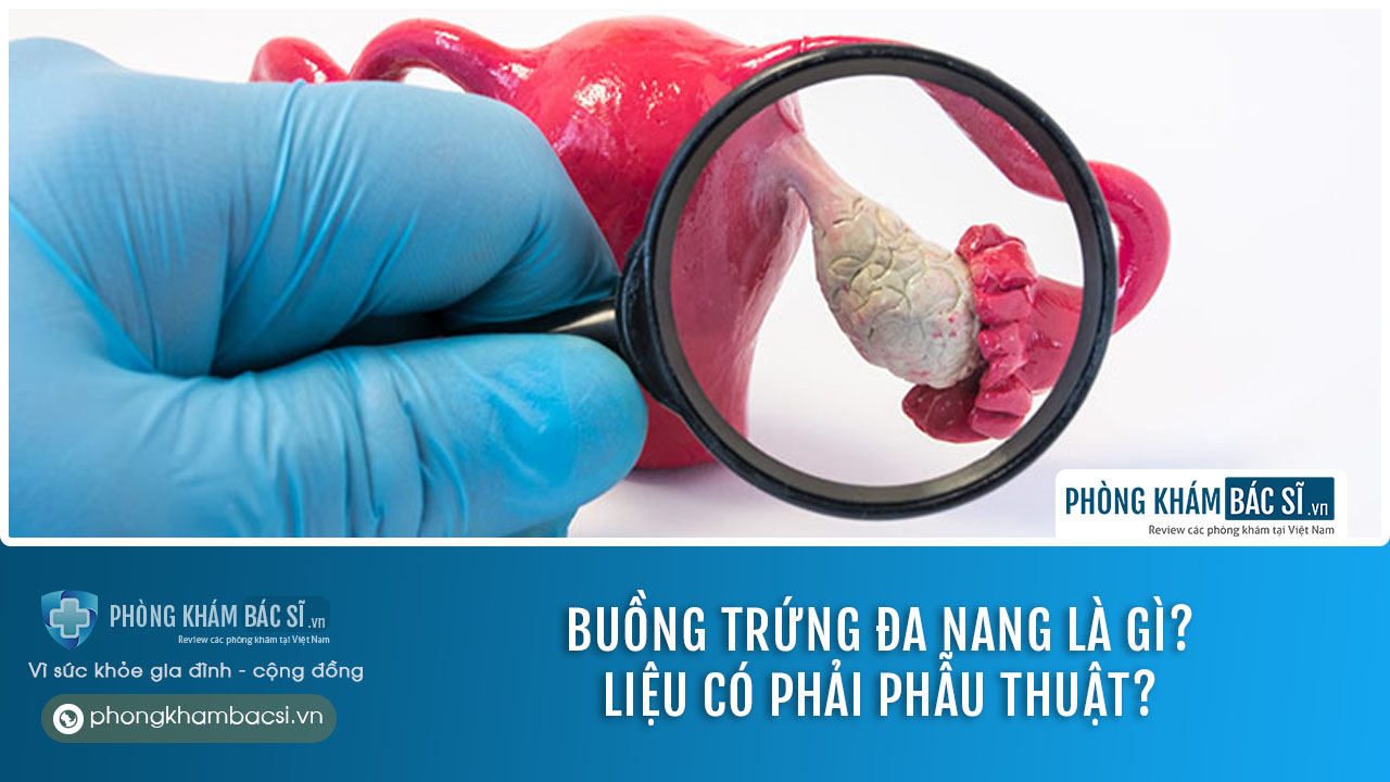 Buồng trứng đa nang là gì? Nguyên nhân, Dấu hiệu và Chữa trị