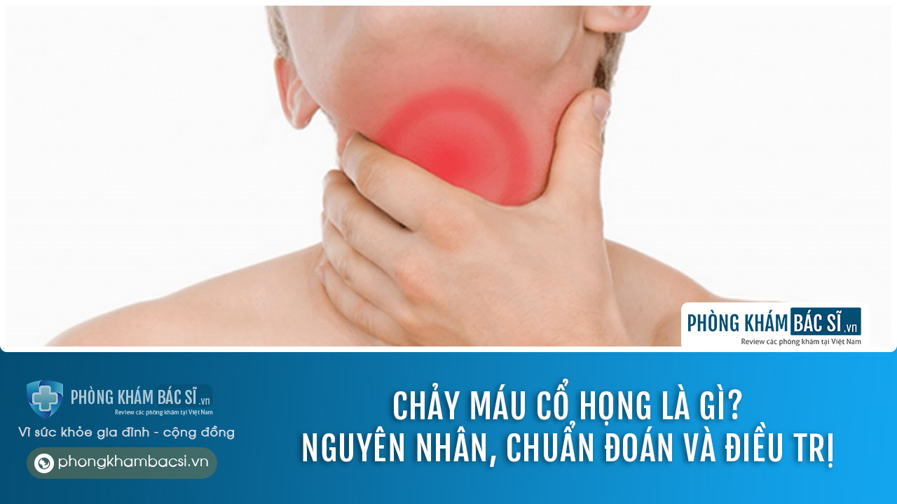 Chảy máu cổ họng là gì? Nguyên nhân, Chuẩn đoán và Chữa trị