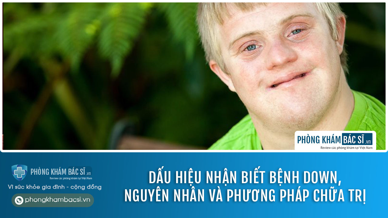 chữa trị bệnh down