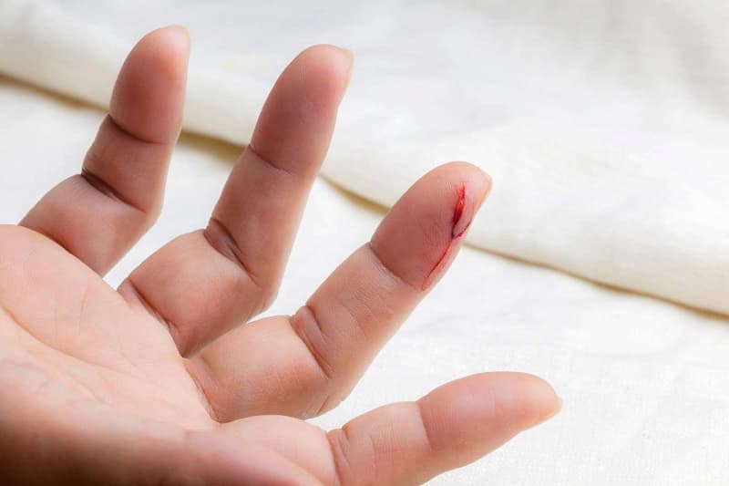 Triệu chứng của bệnh máu khó đông