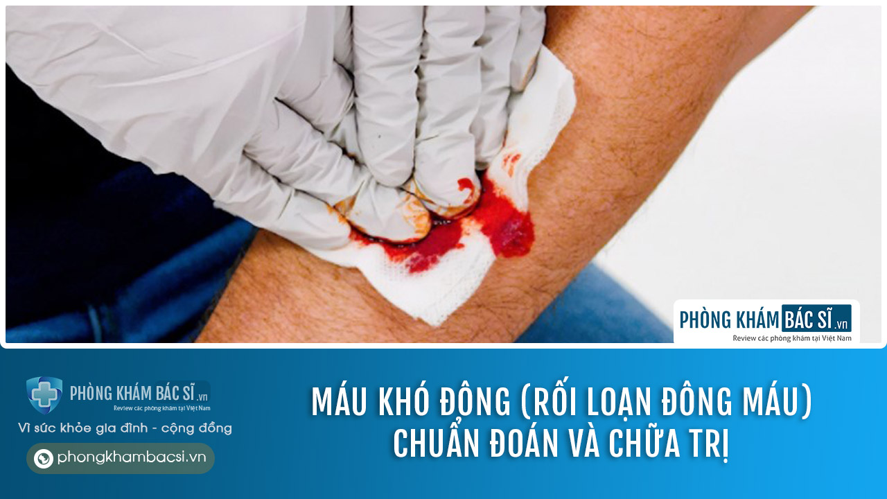 Máu khó đông (Rối loạn đông máu): Chuẩn đoán và chữa trị