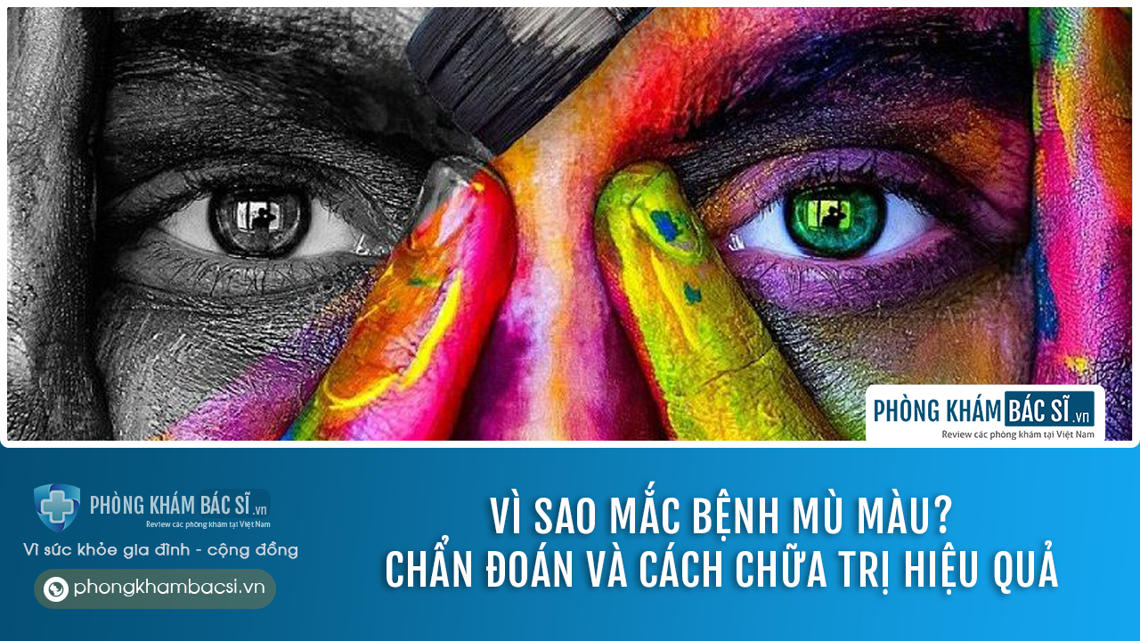 Vì sao mắc bệnh mù màu? Chẩn đoán và cách chữa trị hiệu quả