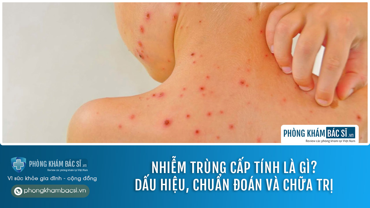 Nhiễm trùng cấp tính: Dấu hiệu, chuẩn đoán và chữa trị
