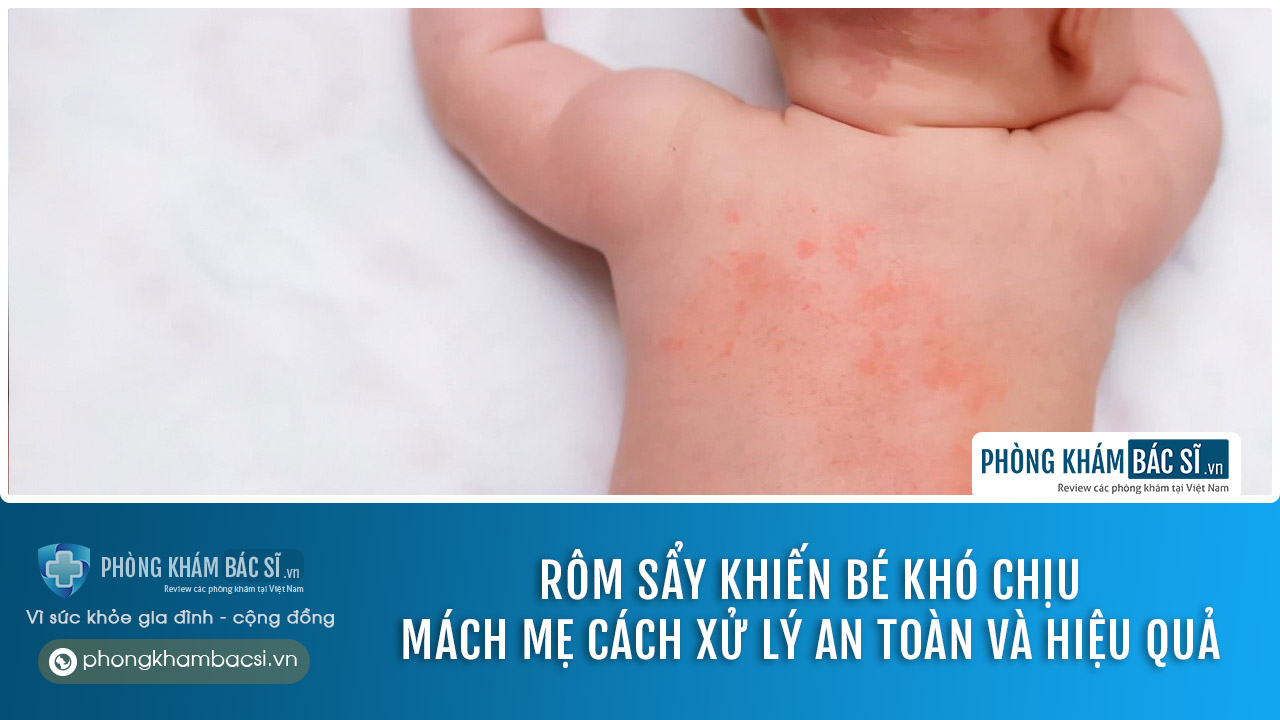 Tình trạng rôm sảy ở trẻ: Nguyên nhân, chuẩn đoán và cách chữa trị