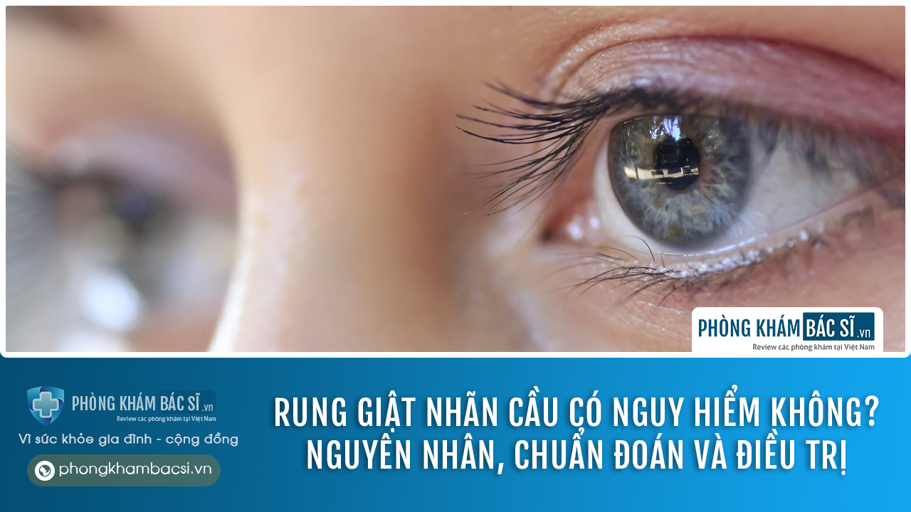 Rung giật nhãn cầu là gì? Nguyên nhân, chuẩn đoán và chữa trị