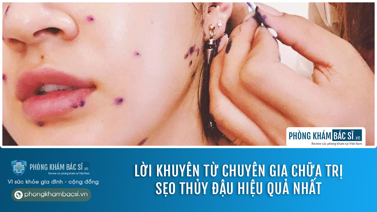 Lời khuyên từ chuyên gia chữa trị sẹo thủy đậu hiệu quả nhất