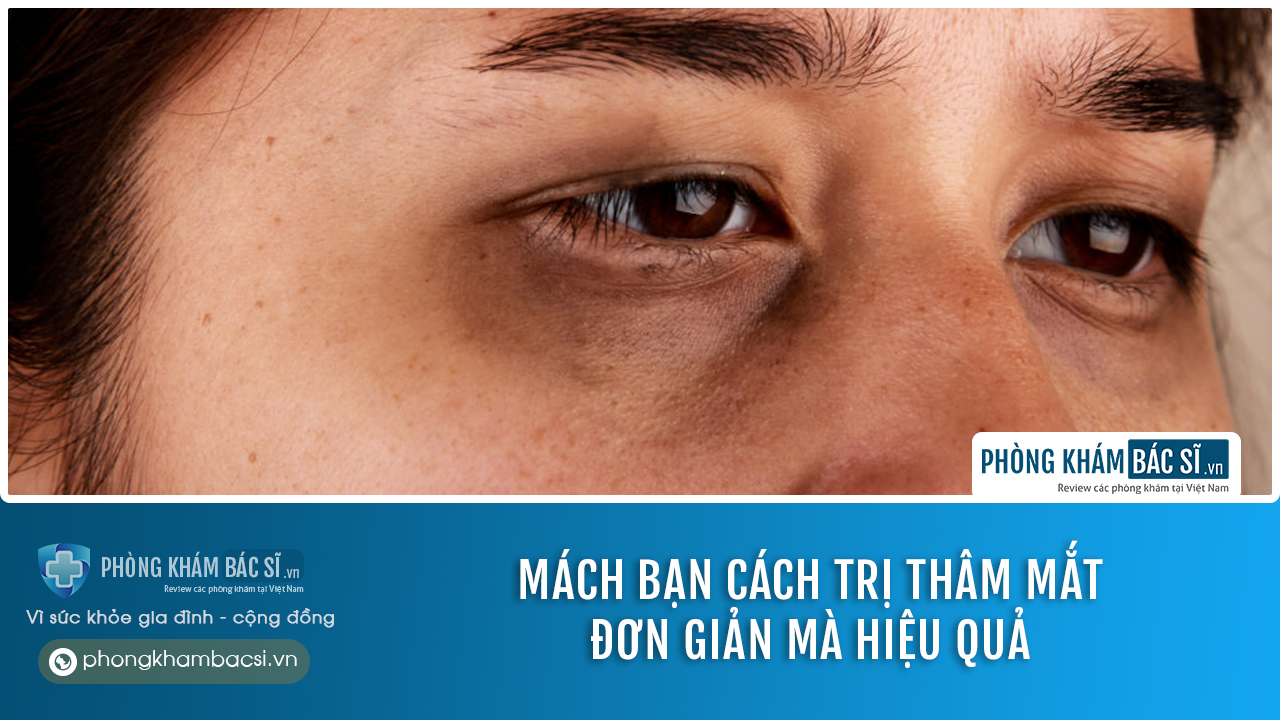 Nguyên nhân và cách chữa trị quầng thâm mắt tại nhà hiệu quả