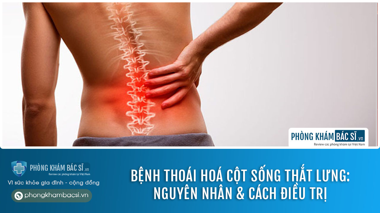 thoái hoá cột sống thắt lưng