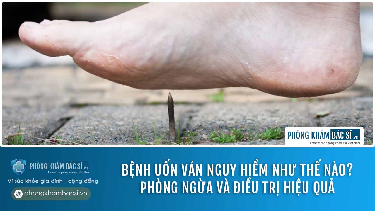 Uốn ván nguy hiểm như thế nào? Chuẩn đoán, điều trị và phương pháp phòng ngừa