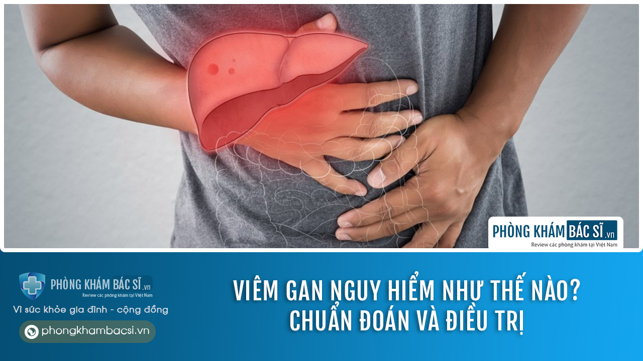 Viêm gan: Nguyên nhân, triệu chứng và chữa trị hiệu quả