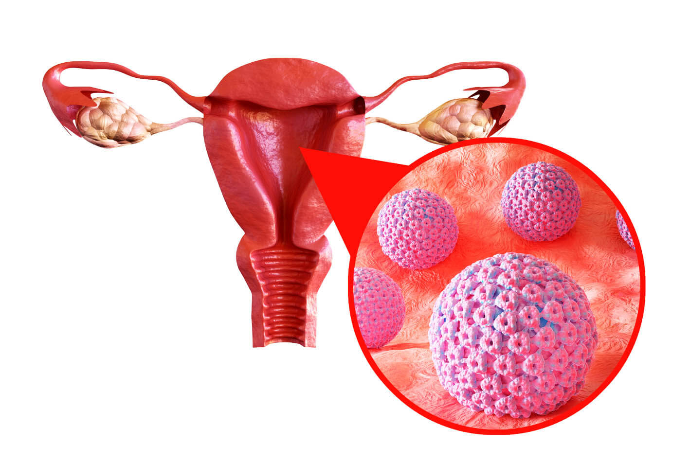 HPV nguy hiểm như thế nào? Nguyên nhân, triệu chứng và cách chữa trị
