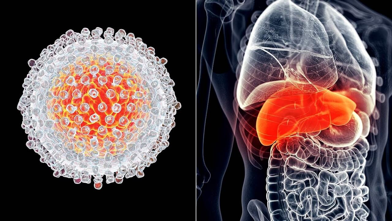 Viêm gan C có nguy hiểm không? Nguyên nhân, triệu chứng và cách chữa trị