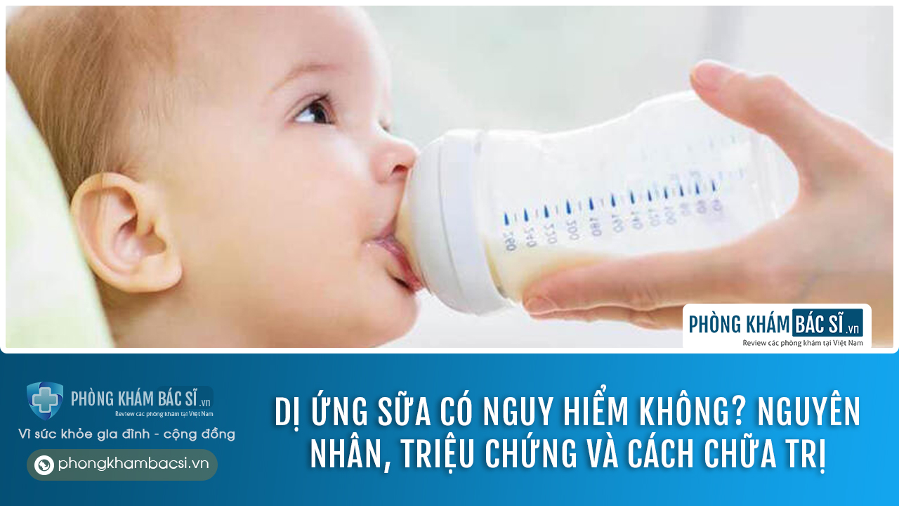 chữa trị dị ứng sữa