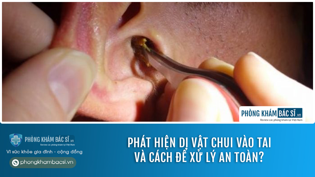 Phát hiện dị vật chui vào tai và cách để xử lý an toàn?