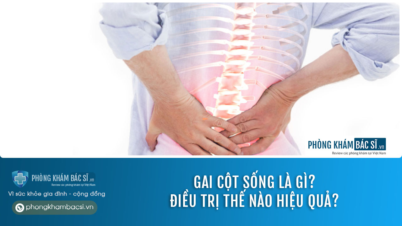 Gai cột sống: Nguyên nhân, Triệu chứng và Phương pháp chữa trị