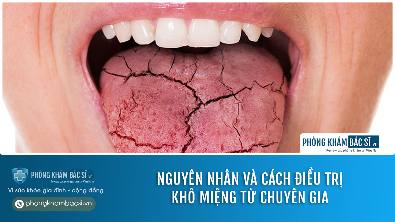 Khô miệng là gì? Nguyên nhân và cách khắc phục an toàn và hiệu quả