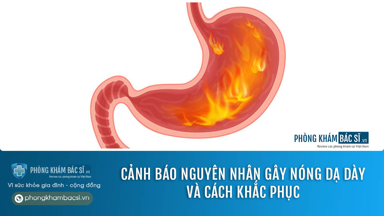 Nóng dạ dày: Nguyên nhân, triệu chứng và cách chữa trị hiệu quả