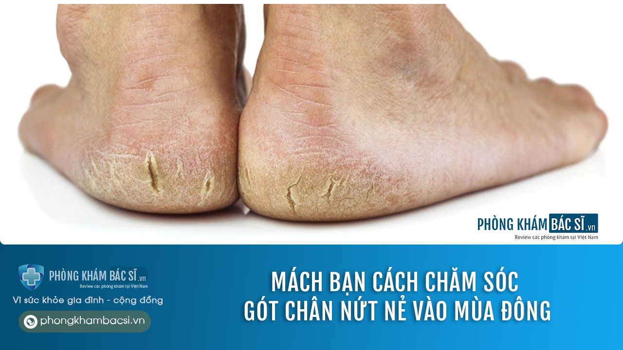 Nứt gót chân: Nguyên nhân và cách chữa trị hiệu quả