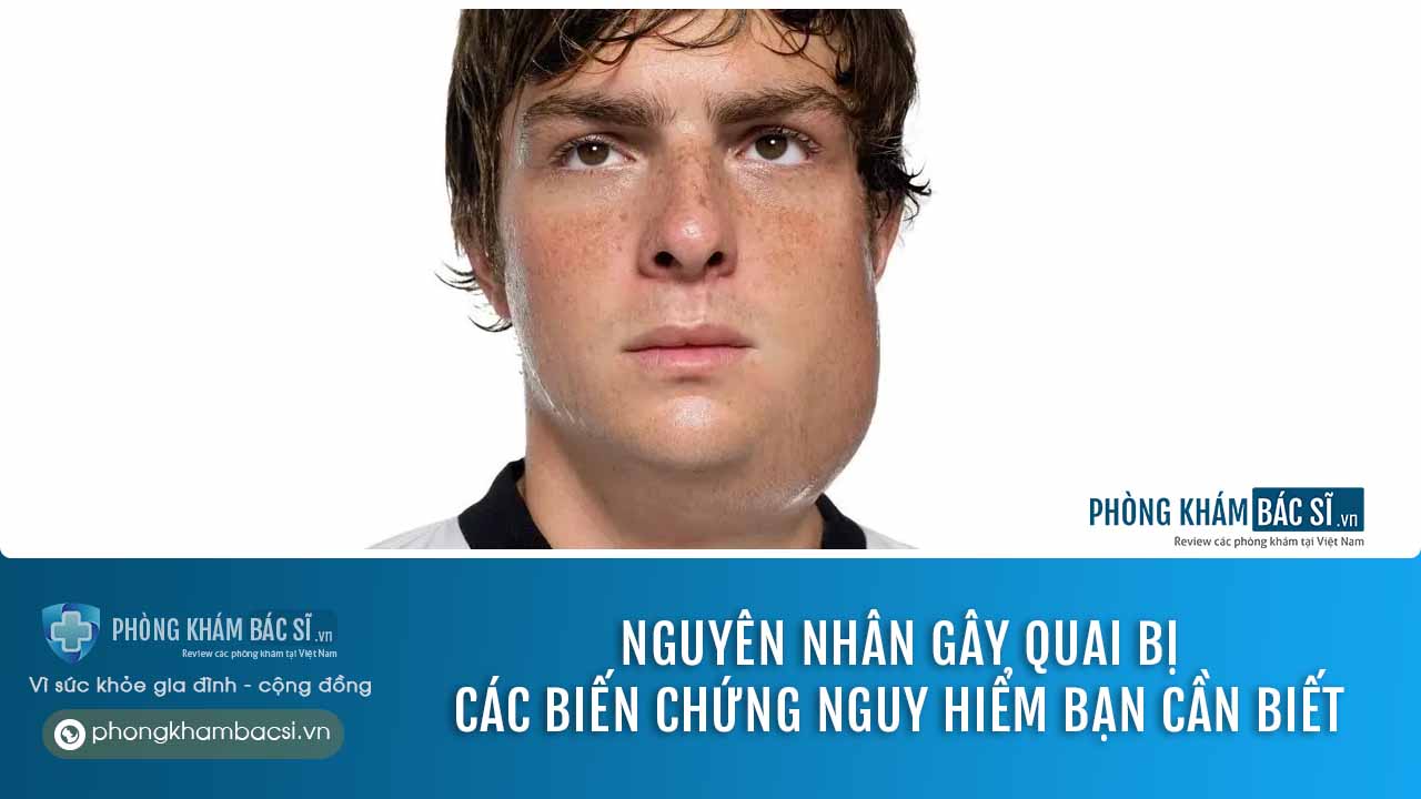 Quai bị: Nguyên nhân, Triệu chứng và Chữa trị hiệu quả
