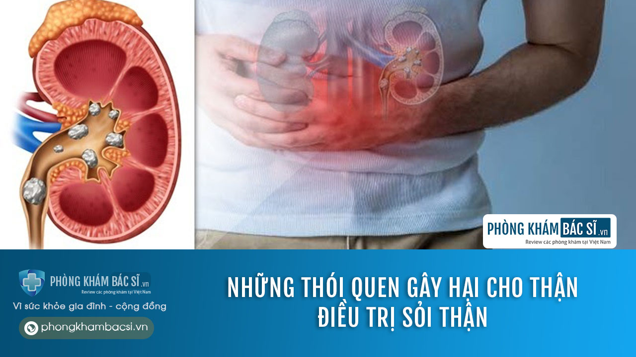 Sỏi thận: Nguyên nhân, triệu chứng và cách chữa trị