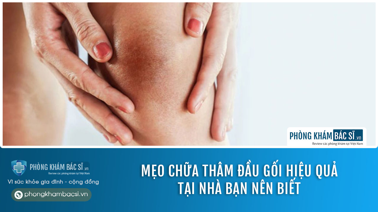 Nguyên nhân gây thâm đầu gối và mẹo chữa trị hiệu quả tại nhà