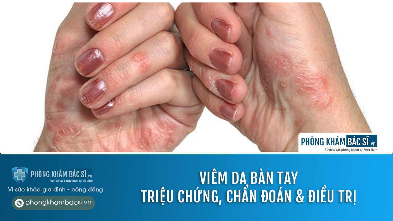 Viêm da bàn tay có lây không? Nguyên nhân, triệu chứng và cách chữa trị