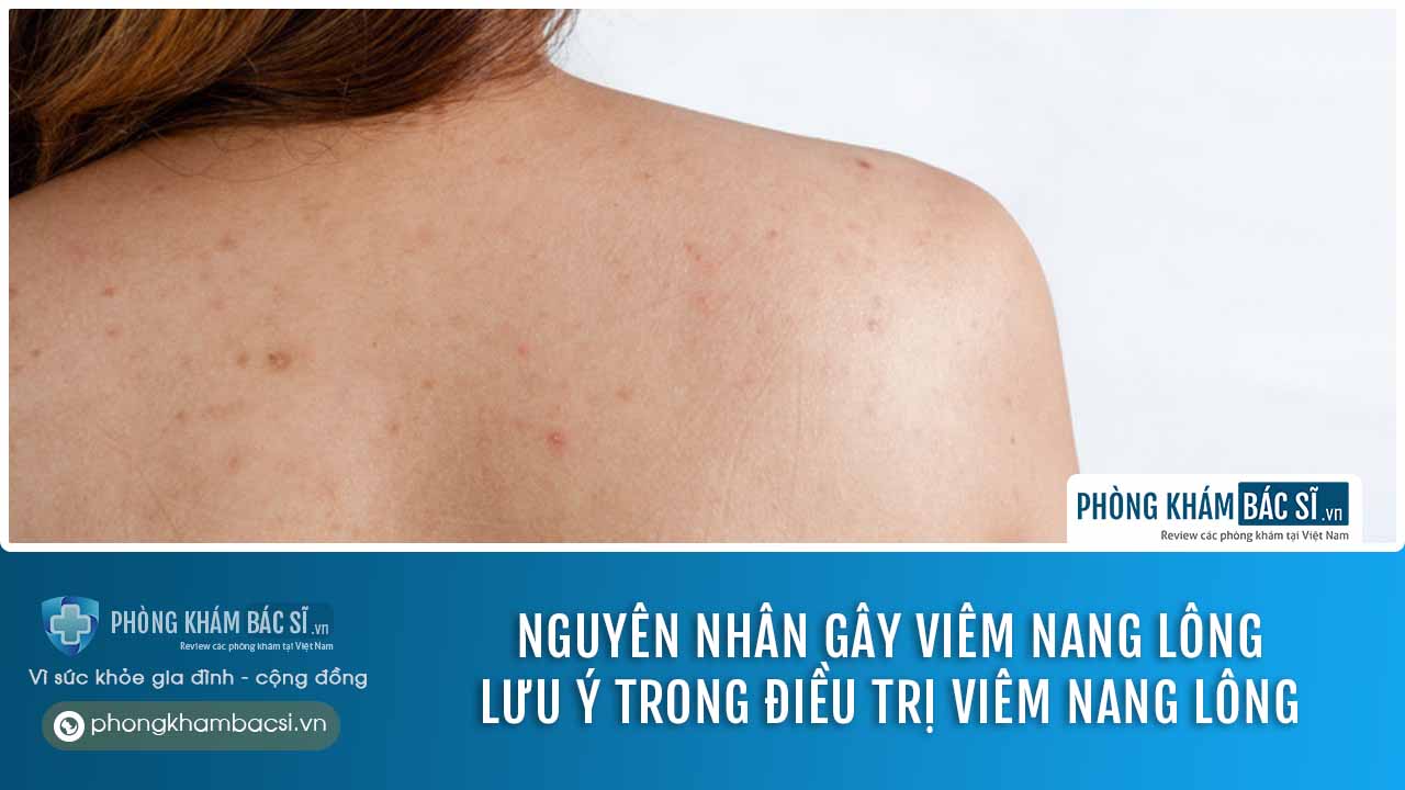 Viêm nang lông có nguy hiểm không? Nguyên nhân, triệu chứng và cách chữa trị