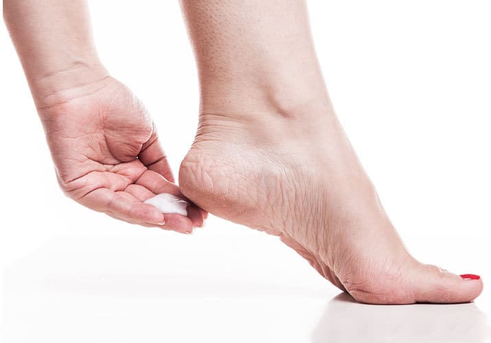 Bệnh nứt gót chân