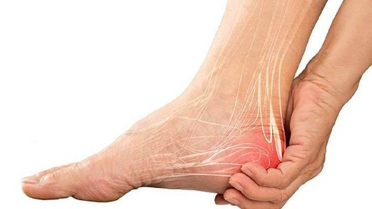 Dấu hiệu nhận biết Gai gót chân? Nguyên nhân và phương pháp chữa trị