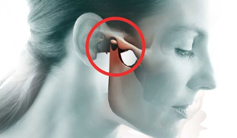 Viêm khớp thái dương: Chuẩn đoán & Phương pháp chữa trị hiệu quả