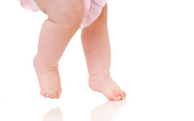 Chân vòng kiềng là gì? Các bài tập khắc phục chân vòng kiềng hiệu quả