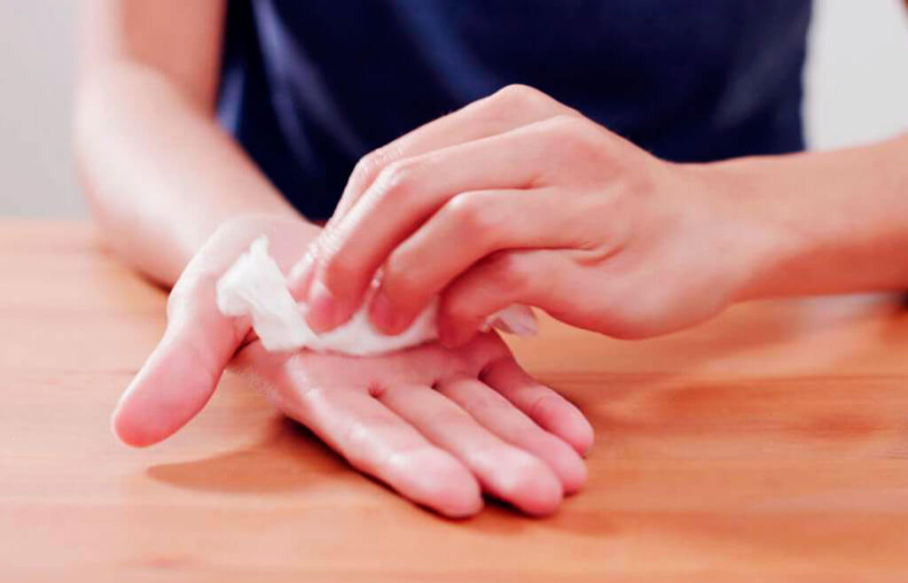Đổ mồ hôi tay chân: Chuẩn đoán & Phương pháp chữa trị hiệu quả nhất
