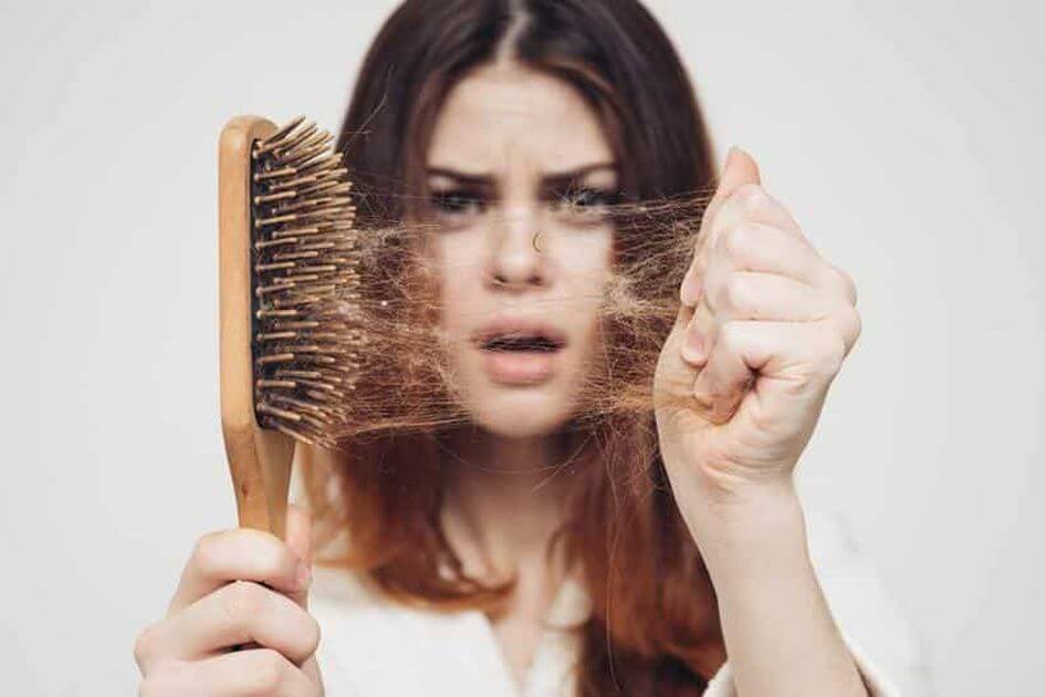 Bị hói đầu phải làm sao? Nguyên nhân, triệu chứng và cách chữa trị