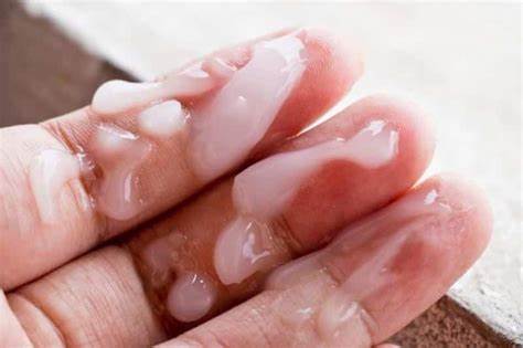 chữa trị tinh dịch vón cục