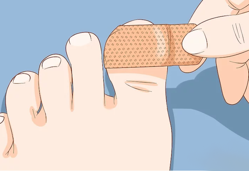 chữa trị lật móng