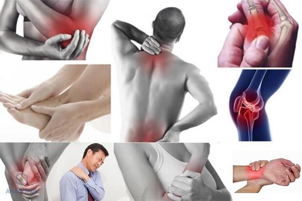 Triệu chứng đau cân cơ