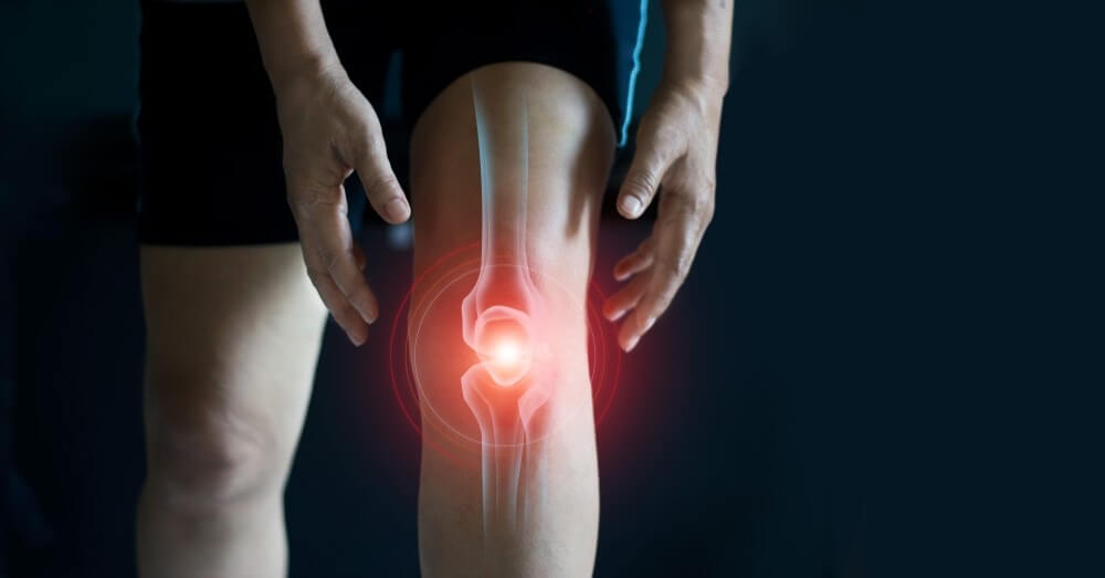 Viêm khớp là gì? Nguy hiểm như thế nào? Nguyên nhân, chẩn đoán và chữa trị