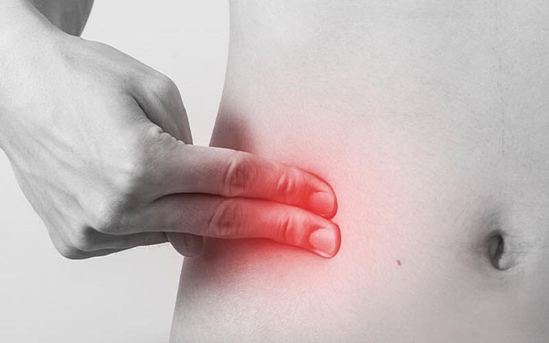 Viêm ruột thừa nguy hiểm như thế nào? Chẩn đoán và cách chữa trị