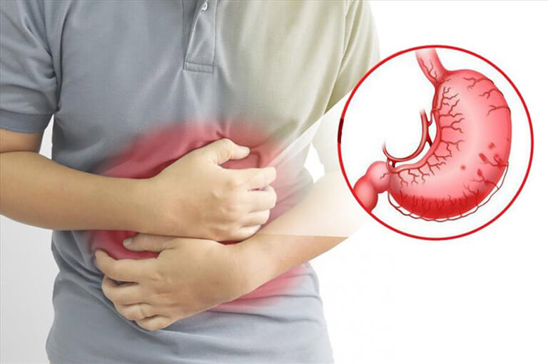 Nguyên nhân gây xuất huyết dạ dày. Chẩn đoán và phương pháp chữa trị