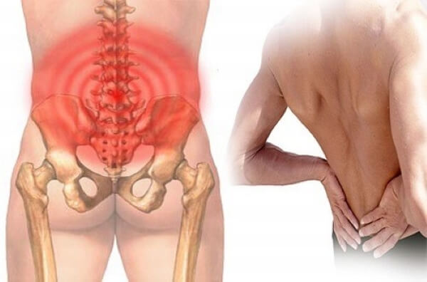 chữa trị đau xương cụt
